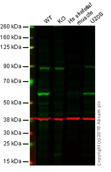 Western blot - Anti-TRAF2 antibody [EPR7064] (AB167163)
