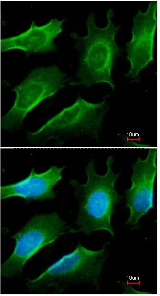 Immunocytochemistry/ Immunofluorescence - Anti-TRAF3 antibody (AB155298)