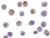 Immunocytochemistry/ Immunofluorescence - Anti-TRAF3 antibody (AB36988)