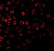 Immunocytochemistry/ Immunofluorescence - Anti-TRAF3 antibody (AB62552)