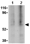 Western blot - Anti-TRAF3 antibody (AB62552), expandable thumbnail