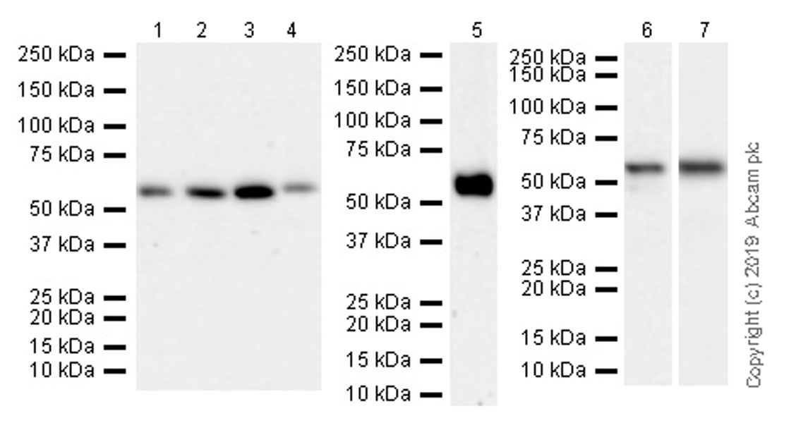 Western blot - Anti-TRAF3 antibody [EPR22992-93] (AB239357), expandable thumbnail
