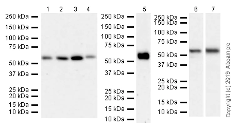Western blot - Anti-TRAF3 antibody [EPR22992-93] (AB239357)