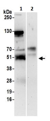 Immunoprecipitation - Anti-TRAF4 antibody (AB245666)