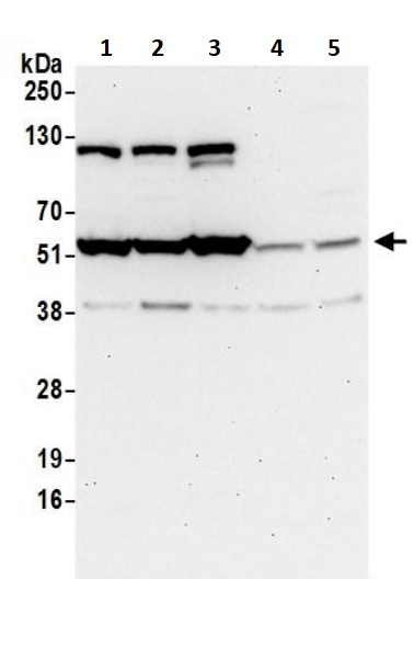 Western blot - Anti-TRAF4 antibody (AB245666)