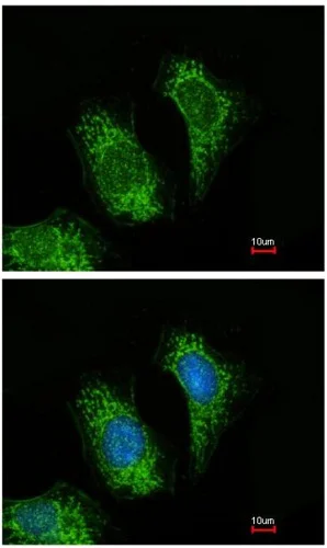 Immunocytochemistry/ Immunofluorescence - Anti-TRAF5 antibody (AB137763)