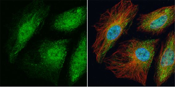 Immunocytochemistry/ Immunofluorescence - Anti-TRAF6 antibody (AB137452), expandable thumbnail