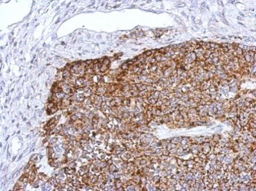 Immunohistochemistry (Formalin/PFA-fixed paraffin-embedded sections) - Anti-TRAF6 antibody (AB137452), expandable thumbnail