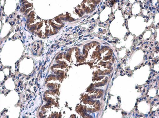 Immunohistochemistry (Formalin/PFA-fixed paraffin-embedded sections) - Anti-TRAF6 antibody (AB137452), expandable thumbnail