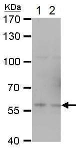 Western blot - Anti-TRAF6 antibody (ab137452), expandable thumbnail