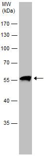 Western blot - Anti-TRAF6 antibody (AB137452), expandable thumbnail