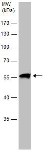 Western blot - Anti-TRAF6 antibody (AB137452)