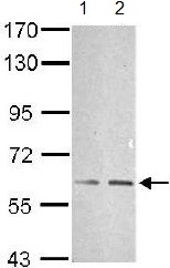 Western blot - Anti-TRAF6 antibody (ab137452), expandable thumbnail