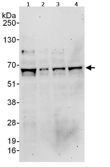 Western blot - Anti-TRAF6 antibody (AB245319)