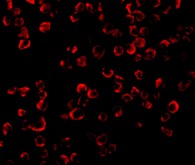 Immunocytochemistry/ Immunofluorescence - Anti-TRAF6 antibody (AB62488)