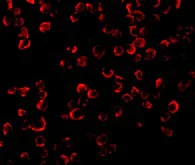 Immunocytochemistry/ Immunofluorescence - Anti-TRAF6 antibody (AB62488)