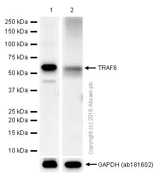Western blot - Anti-TRAF6 antibody [EP591Y] (AB33915)
