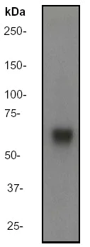 Western blot - Anti-TRAF6 antibody [EP591Y] (AB33915)