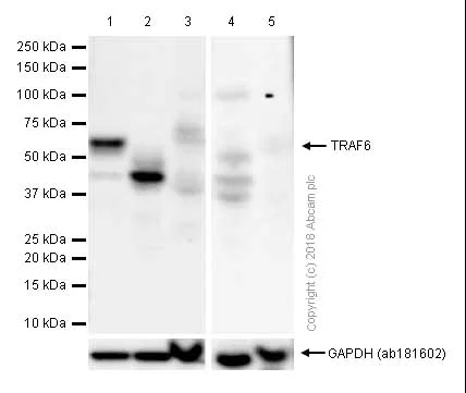 Western blot - Anti-TRAF6 antibody [EP591Y] (AB33915)
