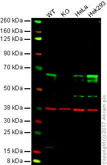 Western blot - Anti-TRAF6 antibody [EP591Y] - BSA and Azide free (AB218575)