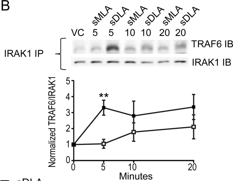 Western blot - Anti-TRAF6 antibody [EP591Y] - BSA and Azide free (AB218575)