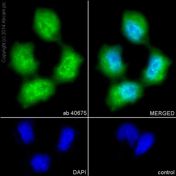 Immunocytochemistry/ Immunofluorescence - Anti-TRAF6 antibody [EP592Y] (AB40675)