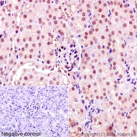 Immunohistochemistry (Formalin/PFA-fixed paraffin-embedded sections) - Anti-TRAF6 antibody [EP592Y] (AB40675)
