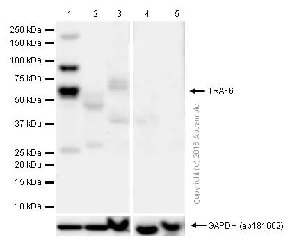 Western blot - Anti-TRAF6 antibody [EP592Y] (AB40675)
