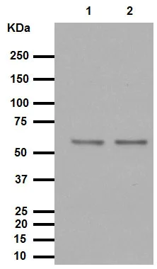 Western blot - Anti-TRAF6 antibody [EP592Y] (AB40675)