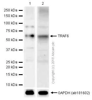 Western blot - Anti-TRAF6 antibody [EP592Y] (AB40675)