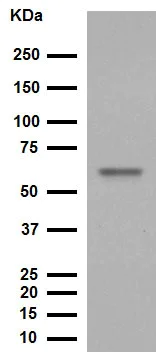 Western blot - Anti-TRAF6 antibody [EP592Y] (AB40675)