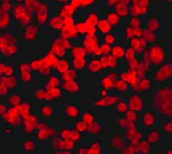 Immunocytochemistry/ Immunofluorescence - Anti-TRAF6 antibody [EP592Y] - BSA and Azide free (AB227560)