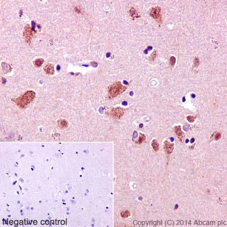Immunohistochemistry (Formalin/PFA-fixed paraffin-embedded sections) - Anti-TRAF6 antibody [EP592Y] - BSA and Azide free (AB227560)
