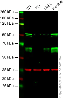 Western blot - Anti-TRAF6 antibody [EP592Y] - BSA and Azide free (AB227560)