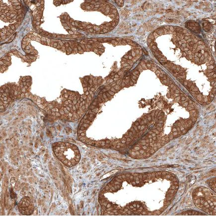 Immunohistochemistry (Formalin/PFA-fixed paraffin-embedded sections) - Anti-TRAF6BP/TAX1BP1 antibody (AB121812)