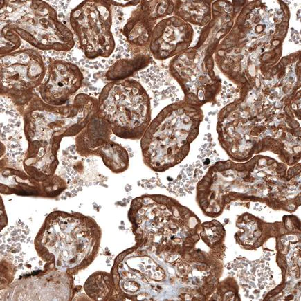 Immunohistochemistry (Formalin/PFA-fixed paraffin-embedded sections) - Anti-TRAF6BP/TAX1BP1 antibody (AB121812)