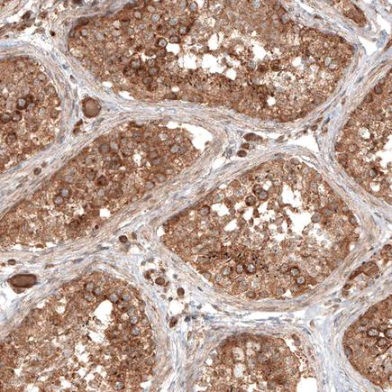 Immunohistochemistry (Formalin/PFA-fixed paraffin-embedded sections) - Anti-TRAF6BP/TAX1BP1 antibody (AB121812)