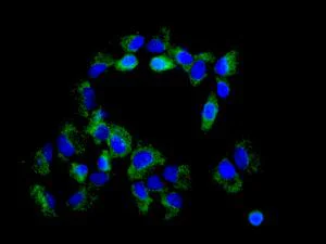 Immunocytochemistry/ Immunofluorescence - Anti-TRAF6BP/TAX1BP1 antibody [EPR13287(B)] - C-terminal (AB176572)