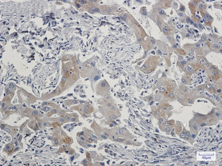 Immunohistochemistry (Formalin/PFA-fixed paraffin-embedded sections) - Anti-TRAF6BP/TAX1BP1 Antibody [S07-6F6] (AB317405)
