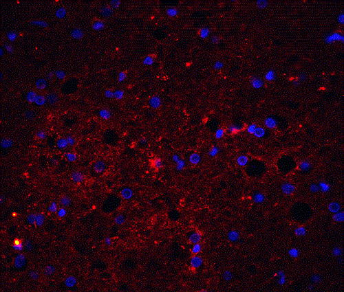 Immunohistochemistry (Formalin/PFA-fixed paraffin-embedded sections) - Anti-TRAIL antibody (AB2056), expandable thumbnail