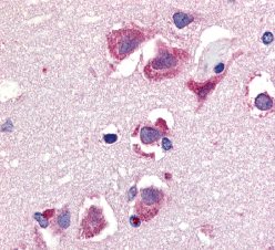 Immunohistochemistry (Formalin/PFA-fixed paraffin-embedded sections) - Anti-TRAIL antibody (AB2056), expandable thumbnail