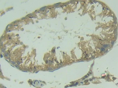 Immunohistochemistry (Formalin/PFA-fixed paraffin-embedded sections) - Anti-TRAIL antibody (AB231063)