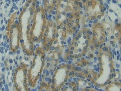 Immunohistochemistry (Formalin/PFA-fixed paraffin-embedded sections) - Anti-TRAIL antibody (AB231063)