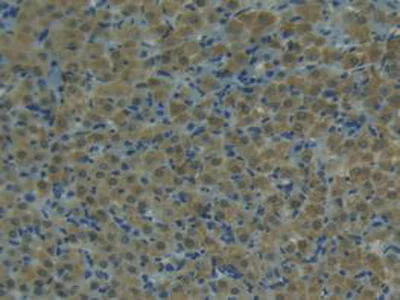 Immunohistochemistry (Formalin/PFA-fixed paraffin-embedded sections) - Anti-TRAIL antibody (AB231063)
