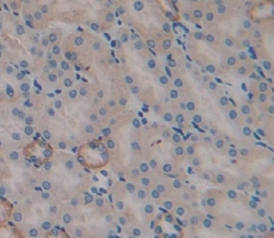 Immunohistochemistry (Formalin/PFA-fixed paraffin-embedded sections) - Anti-TRAIL antibody (AB231265)