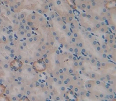Immunohistochemistry (Formalin/PFA-fixed paraffin-embedded sections) - Anti-TRAIL antibody (AB231265)