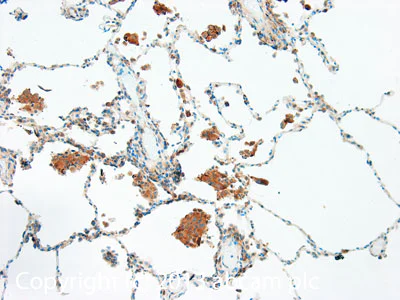 Immunohistochemistry (Formalin/PFA-fixed paraffin-embedded sections) - Anti-TRAIL antibody (AB42121)