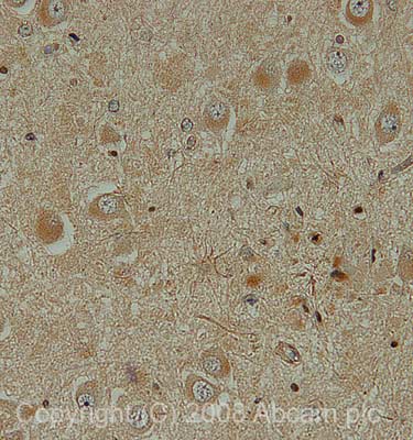 Immunohistochemistry (Formalin/PFA-fixed paraffin-embedded sections) - Anti-TRAIL antibody (AB42121)