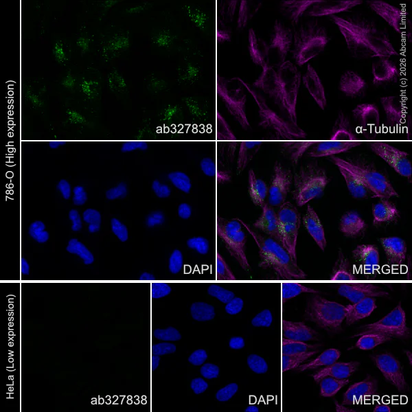 Immunocytochemistry/ Immunofluorescence - Anti-TRAIL antibody [EPR31427-760] (AB327838)