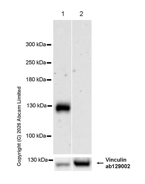 Western blot - Anti-TRAK1 antibody [EPR30574-567] (AB327353)